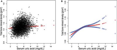 Association of Serum Uric <mark class="highlighted">Acid</mark> Status With Bone Mineral Density in Adolescents Aged 12–19 Years
